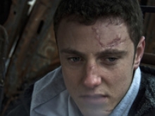 Brain Injury Attorney in Rochester NY Brain Injury Attorney in Rochester NY