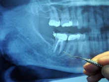 Medical Malpractice Attorney in Rochester NY Medical Malpractice Attorney in Rochester NY